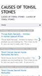 Mobile Screenshot of causesoftonsilstonesss.blogspot.com
