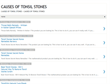 Tablet Screenshot of causesoftonsilstonesss.blogspot.com