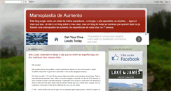 Desktop Screenshot of mamoplastiadeaumento.blogspot.com