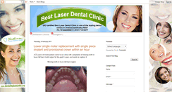 Desktop Screenshot of bestlaserdentalclinic.blogspot.com