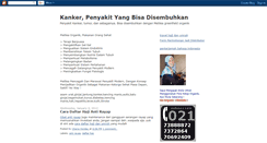 Desktop Screenshot of kanker-talk.blogspot.com