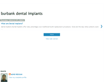 Tablet Screenshot of burbank-dental-implants.blogspot.com