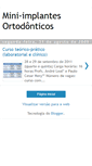 Mobile Screenshot of mini-implantes.blogspot.com