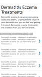 Mobile Screenshot of dermatitis-eczema-treatments.blogspot.com