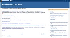 Desktop Screenshot of mesotheliomacurenews2.blogspot.com