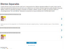 Tablet Screenshot of dientesseparados.blogspot.com