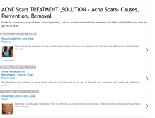 Tablet Screenshot of acnescars-treatment-remedy.blogspot.com