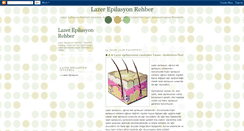 Desktop Screenshot of lazerepilasyon10.blogspot.com