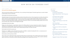 Desktop Screenshot of howmuchdoveneerscost.blogspot.com