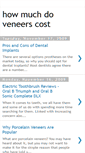 Mobile Screenshot of howmuchdoveneerscost.blogspot.com