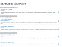 Tablet Screenshot of howmuchdoveneerscost.blogspot.com