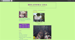 Desktop Screenshot of melanomalisa.blogspot.com