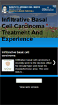 Mobile Screenshot of infiltrativebasalcellcarcinoma.blogspot.com