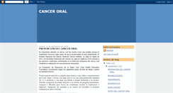 Desktop Screenshot of canceroral.blogspot.com