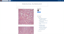 Desktop Screenshot of perinatalpathology.blogspot.com