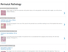 Tablet Screenshot of perinatalpathology.blogspot.com