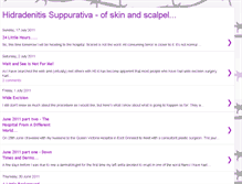 Tablet Screenshot of hssurgeryskinandscalpelsin.blogspot.com