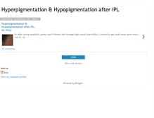 Tablet Screenshot of hypopigmentationipl.blogspot.com