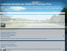 Tablet Screenshot of implantesdentalesdetitanio.blogspot.com