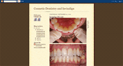 Desktop Screenshot of millercosmeticdentistry.blogspot.com