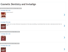 Tablet Screenshot of millercosmeticdentistry.blogspot.com