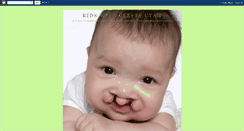 Desktop Screenshot of kidswithcleftsutah.blogspot.com