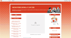 Desktop Screenshot of mesothelioma-stories.blogspot.com