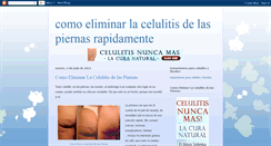 Desktop Screenshot of comoeliminarlacelulitisdelaspie.blogspot.com