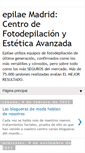Mobile Screenshot of fotodepilacion-segura-madrid.blogspot.com