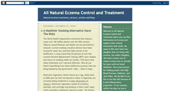 Desktop Screenshot of naturaleczemacontrol.blogspot.com