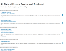 Tablet Screenshot of naturaleczemacontrol.blogspot.com