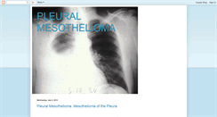 Desktop Screenshot of about-pleuralmesothelioma.blogspot.com