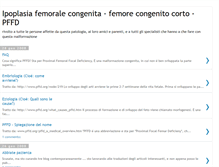 Tablet Screenshot of ipoplasiafemoralecongenita.blogspot.com