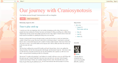 Desktop Screenshot of journeywithcraniosynotosis.blogspot.com