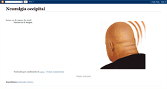 Desktop Screenshot of neuralgiaoccipital.blogspot.com