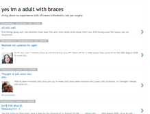 Tablet Screenshot of adultwithbraces.blogspot.com