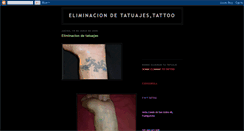 Desktop Screenshot of eliminatutattoo.blogspot.com