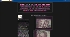 Desktop Screenshot of donoreggivfgirl.blogspot.com
