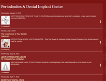 Tablet Screenshot of bloomingtondentalimplants.blogspot.com