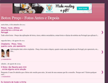 Tablet Screenshot of botoxprecoantesedepois.blogspot.com