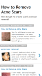 Mobile Screenshot of howto-remove-acne-scars.blogspot.com