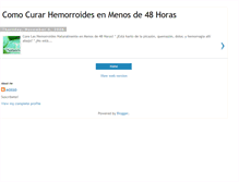 Tablet Screenshot of cura-hemorroides.blogspot.com
