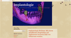 Desktop Screenshot of implantologie-bochum.blogspot.com