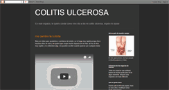 Desktop Screenshot of colitisulcerosa.blogspot.com