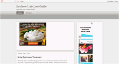 Desktop Screenshot of ieyebrowhairloss.blogspot.com