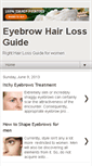 Mobile Screenshot of ieyebrowhairloss.blogspot.com