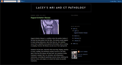 Desktop Screenshot of laceyspathologyexperience.blogspot.com