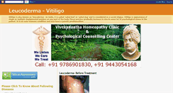 Desktop Screenshot of leucodermavitiligo.blogspot.com