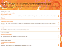 Tablet Screenshot of hairlosstransplant.blogspot.com