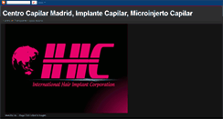 Desktop Screenshot of implantecapilar-ihic.blogspot.com